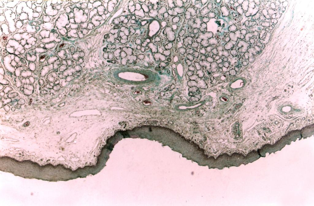 in the uvular mucosa (Verhoeff, 100).