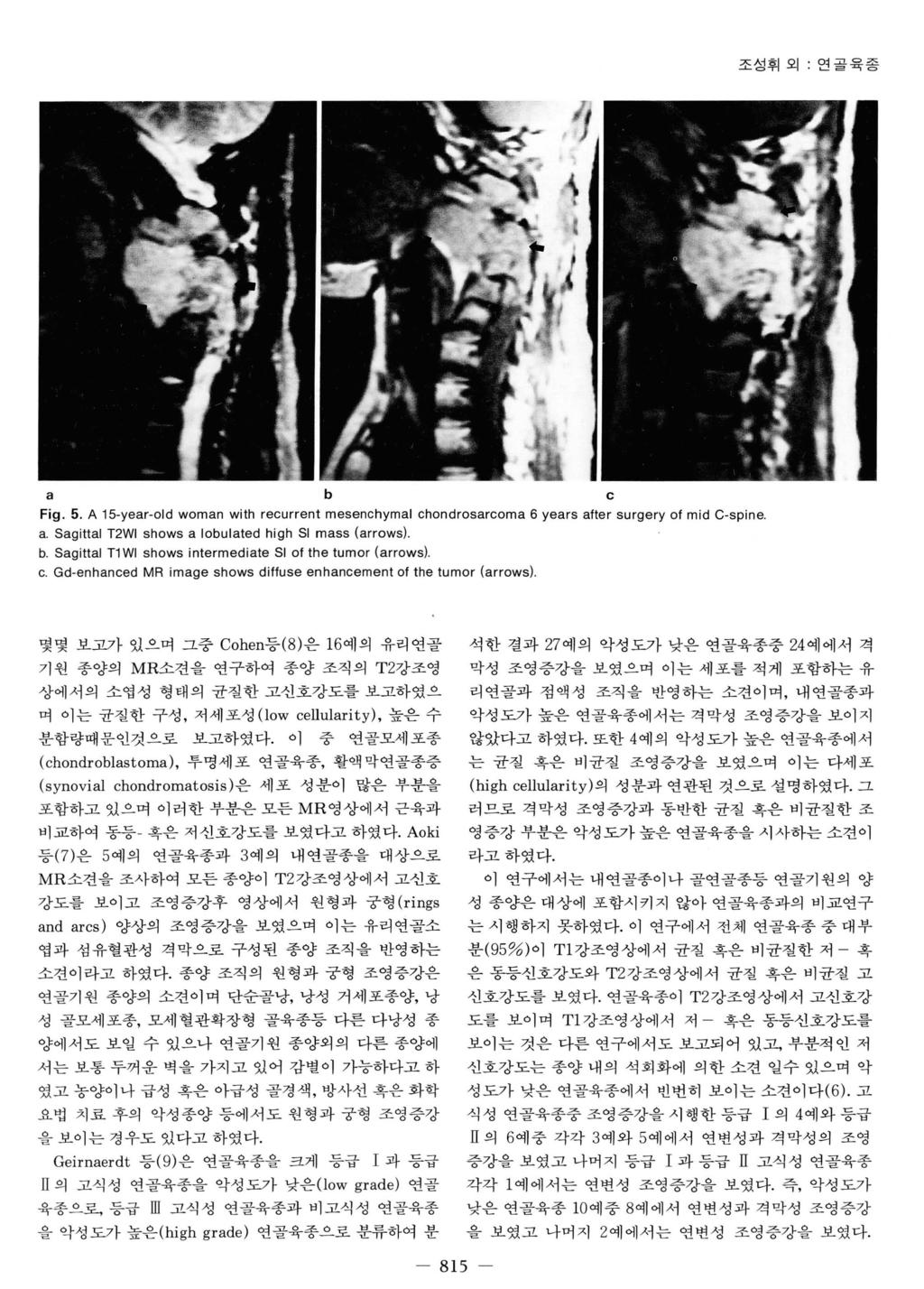 조성휘오 I : 연골육종 a b c Fig. 5. A 15-year-old woman with recurrent mesenchymal chondrosarcoma 6 years after surgery 01 mid C-spine. a. Sagittal T2WI shows a lobulated high SI mass (arrows). b. Sagittal T1 WI shows intermediate SI 01 the tumor (arrows) c.