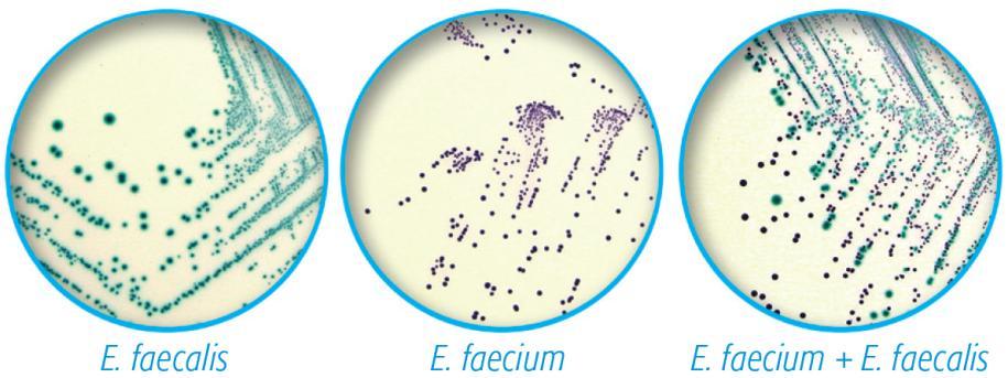 37. Staphylococci cefoxitin (mm): 30 µg MIC (µg/ml) S. aureus, S. lugdunensis 22 21 4 8 Coagulase staphylococci 25 24 3.3.. 32. 3.4. meca meca penicillin 2a (PBP 2a, PBP2 ) mecamediated oxacillin.