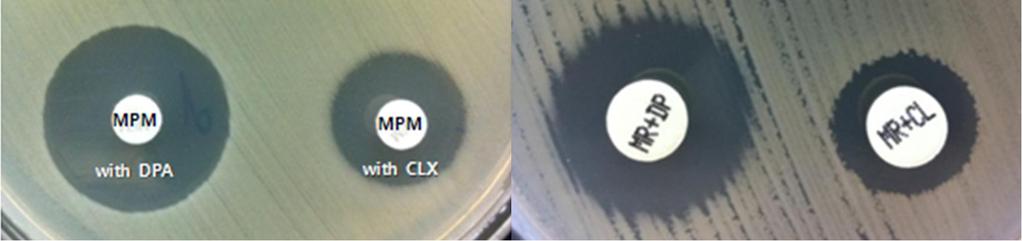 (A) combined disk : DPA, (B) Rosco ID : MRDP, (C)
