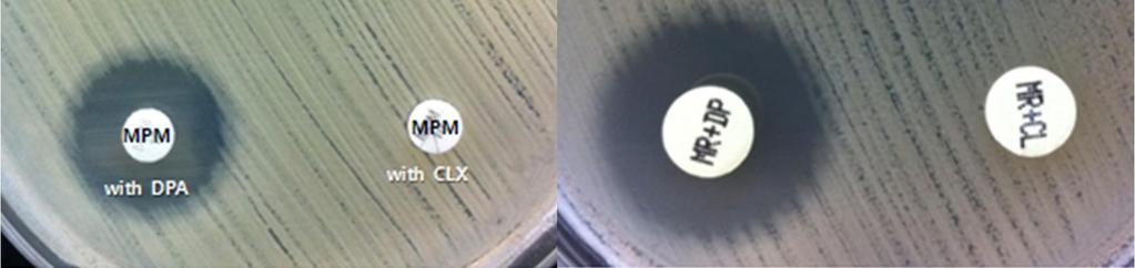(A) combined disk : DPA, (B) Rosco ID : MRDP, (C)