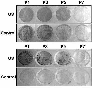 성인중간엽줄기세포의계대배양에따른특성변화 P1 P3 P5 P7 OS Control P1 P3 P5 P7 OS Control Fig. 4. 계대배양에따른중간엽줄기세포의골아세포능분석 Table 3. 프로테오믹스를이용한계대배양중변화단백질 No.