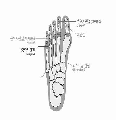 6) 발가락에뚜렷한장해를남긴때 라함은첫째발가락의경우에중족지관절과지관절의굴신 ( 굽히고펴기 ) 운동범위합계가정상운동가능영역의 1/2 이하가된경우를말하며, 다른네발가락에있어서는중족지관절의신전운동범위만을평가하여정상운동범위의 1/2 이하로제한된경우를말한다.