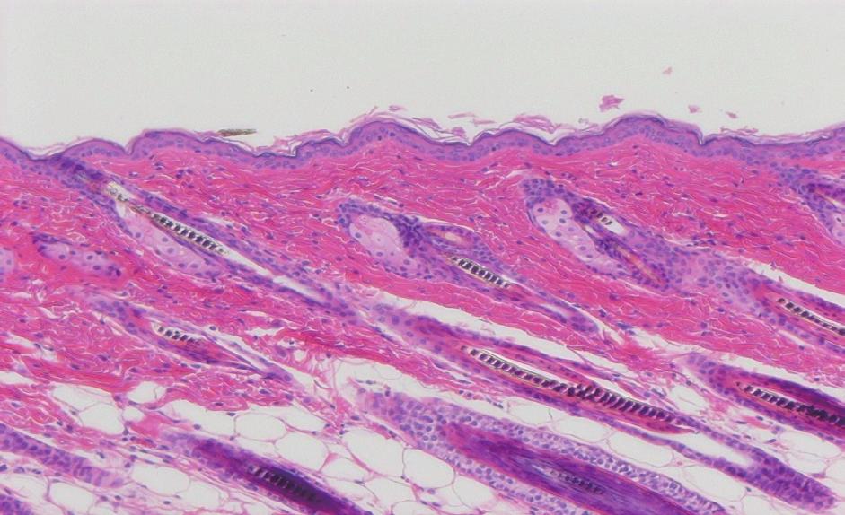 with N group. Fig. 3. Histological observation on hair growth in an  weeks.