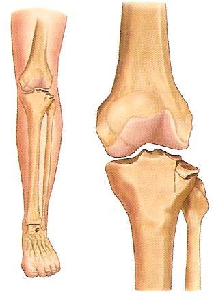 5. 신체부위별골절처치 6) 무릎뼈 ( 슬개골 ) 골절 (1) 증상 -