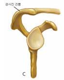 일차적외적충돌 Primary External Impingement 원인 Osteophyte( 골극 ) or Beak