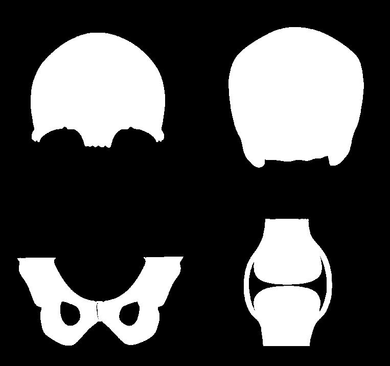 Bone ( 뼈 ) & Skeleton ( 뼈대 )