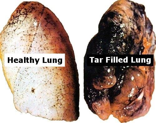 담배및담배연기의주요성분 A 급발암물질 담배한개비