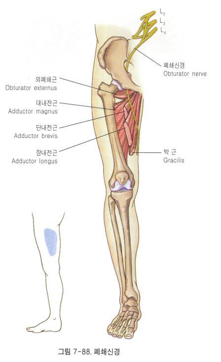 3. 폐쇄신경병증 (Obturator neuropathy) Hip adductor muscle( 두덩정강근, 긴모음근, 짧은모음근, 큰모음근 ) Hip external rotation muscle 원인 - 관통상, 외상, 골반의심한외상, femur