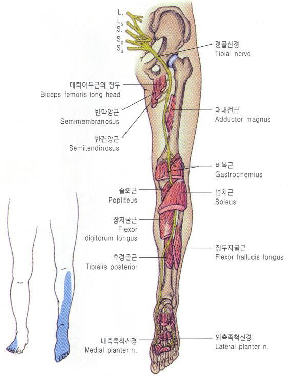 5. 종아리신경병변 (Peroneal Nerve Lesions) L4, 5 & S1, 2 원인 - fixed compression - swelling - fibular head fracture 임상적증상 - foot drop : high steppage gait - muscle weakness : dorsiflexor, ankle everters,
