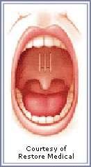 02 한국의료관광주요상품모델소개 Treatment - Surgery of nose and throat, tonsillectomy, early diagnosis of laryngeal cancer, snoring correction - Treatment of chronic sinusitis, allergic rhinitis, vocal nodules,
