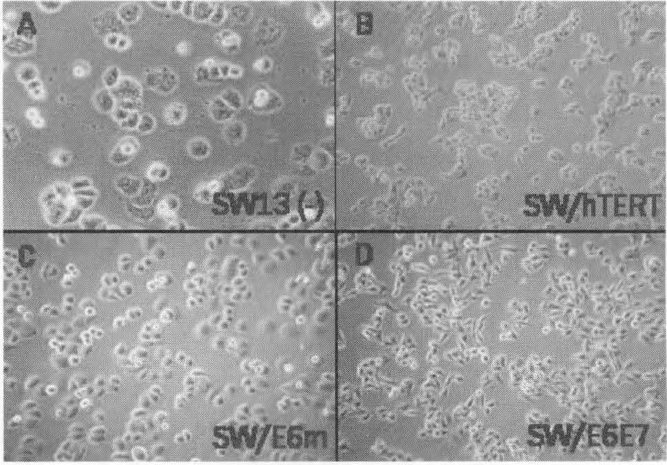 SW/hTERT 세 포의경우, SW13/Mock 세포와비교하였을때, 세포형태 의변화는거의없었으나세포의크기가작아졌고, 세포의분열시간이조금빨라졌다. 반면에 HPV oncogene들이발현되는 SW13 의경우세포의형태가 Mock 세포에비해많이변하였으며특히 SW/E6E7 의경우는세포가바닥에부착하는정도가심해졌고세포의모양이길쭉하게변했다.
