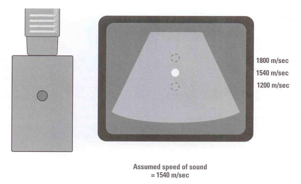 speed of sound artifact < 그림 7-42> : soft tissue (1540 m/s) 1540