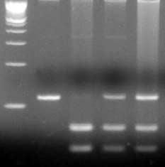 236 장순희 이난영 김동환외 2 인 3. FLT3 유전자변이유무에따른예후인자들과의관련성분석결과 FLT3 유전자변이를예후인자들과분석한결과, 백혈구수, 나이, 염색체분석결과와는상관관계가없었으나, LD치와는순상관관계가있는것으로나타났다 (P=0.013)(Table 2). 4.