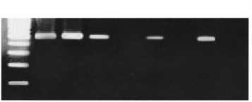 178 김지은 김영아 박성신외 3 인 L M U 1m 1u 2m 2u 3m 3u Fig. 4. Methylation specific PCR analysis for EBV Cp. Lane L, 100 bp marker; M, positive control of methylated Cp.