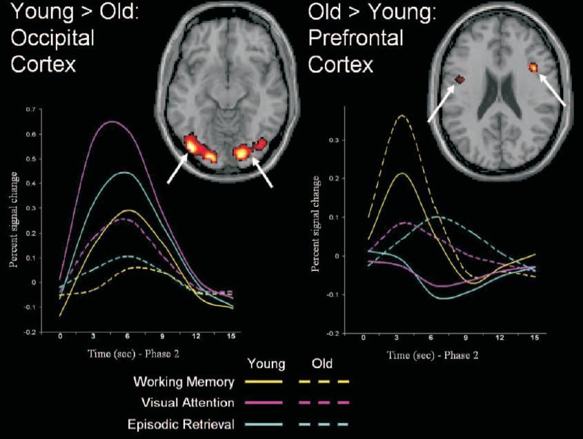 Plasticity of Aging Brain Older brain Life-long capacity for