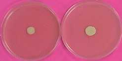 ccharomyces kluyveri Phaff et al 그림 15. S. kluyveri Phaff et al 균총 (5 일, 10 일 ) 특징 : 다른곰팡이와달리균총의자라는속도가느리며둔탁한크림색으로균사형태가아닌약한줄무늬가있거나약간볼록하고매끈하다.