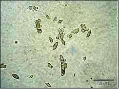 11) Cladosporium 속 Cladosporium cladosporioides de