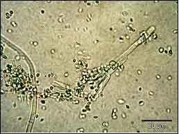 . 그림 92. P. hirsutum Dierckx 분생포자 (200x) < 왼쪽 >, 스케치 < 오른쪽 > Penicillium italicum Wehmer. 그림 93. P. italicum Wehmer 분생포자경및분생포자 (1000x) < 왼쪽 >, 스케치 < 오른쪽 > Penicillium roqueforti Thom.
