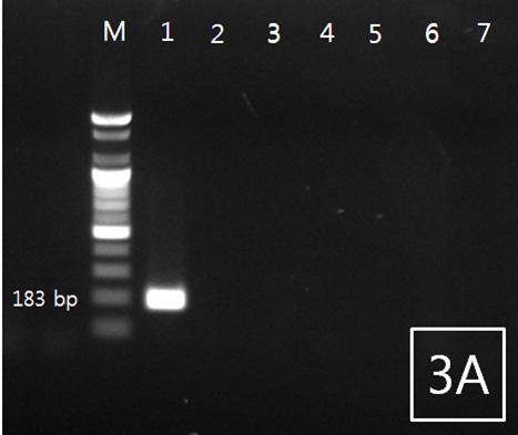 736 서한길ㆍ서정수ㆍ류민경ㆍ이은혜ㆍ정승희ㆍ한현자 paralichthydis (species). COI, COI. PCR 18S rrna 2 primer set (Fig. 1). Primer, 18S rrna Philometrodae 18S rrna primer. DNA PCR 2 primer set, agarose gel 183 206 bp band.