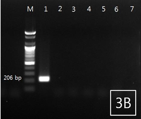 RN-18S 1 2 primer sets. (data not shown), Philometrid nematodes. primer plasmid DNA,. 18S rrna plasmid DNA 1 10 10 copy 1 10 3 copy band primer (Fig. 4A, 4B). Philometrid nematodes,.