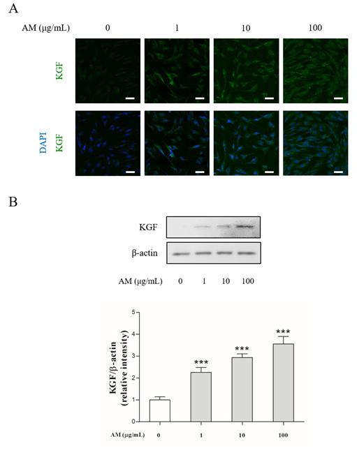 黃芪추출물의외용도포가자발성원형탈모생쥐에미치는영향 (7) Fig. 5. A. membranaceus decreases the mrna expressions of cytokines in skin tissues. Expression of TNF-α, IL-4 and IFN-γ mrna levels by RT-PCR (A) and qpcr (B).