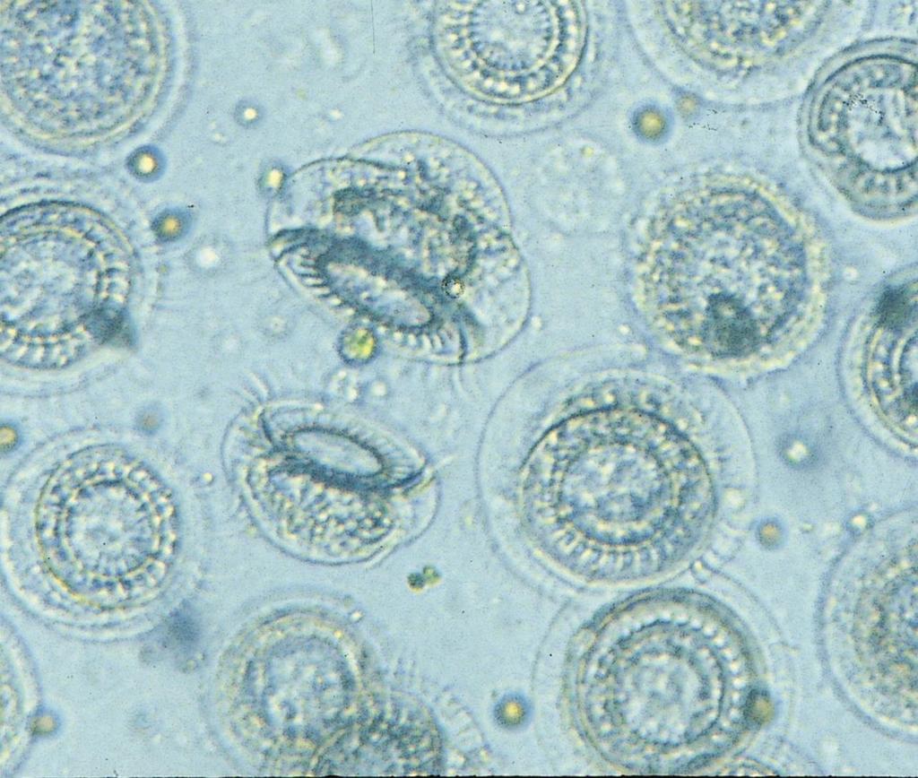 세포세계에대한소개 현미경으로세포의구조와기능을연구한다 원생생물인 Trichodina 의광학현미경사진 광학현미경 (light microscope, LM): 0.
