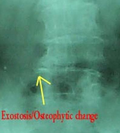Full Spine Technique Protocol (Diagnosis) X-ray check (