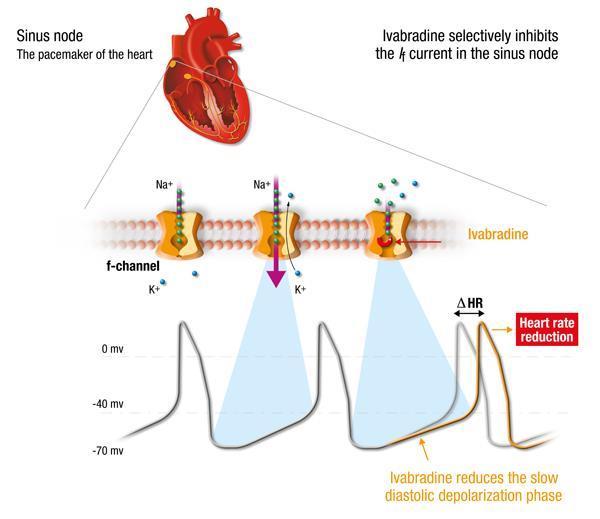 이바브라딘 (Ivabradine) Heart rate as a risk factor in choronic heart