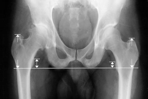 sartorius m. rectus femoris m. adductor m. gracilis m.