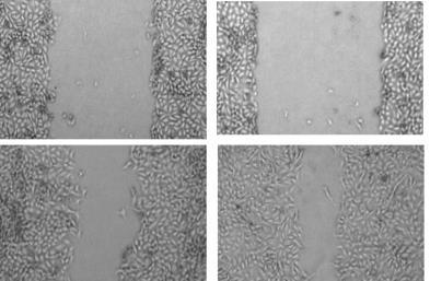 피부보호효과 HaCat Cell 을 1x1^4/well 이되도록 96well plate 에분주한후 24 시간배양. Β-glucan, BST-CR 가첨가된배지로교환한후초미립자용액을처리하여경과확인. 그결과 BST-CR 은무처리구에비하여 2 배이상세포생존율을보였으며, Β-glucan 보다우수한효과를보임.
