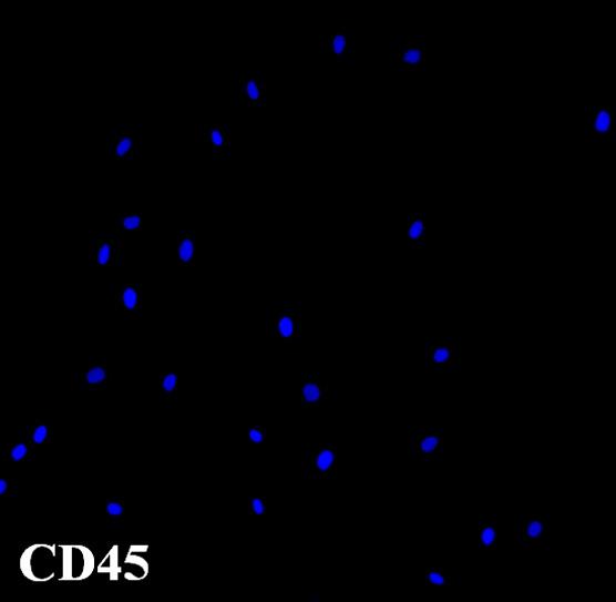TBS Tween-20으로 5분간 3회수세후이차항체로 anti-mouse peroxidase (DAKO K4001, Produktionsvej, Denmark) 를가하여 30분간반응시킨후 TBS Tween 20으로수세하고 DAB (3,3
