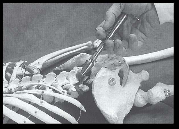 L4 Adjustment Contact Point : the mammillary process on the side indicated by