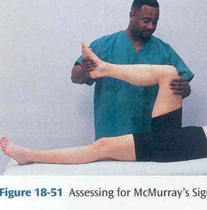 근골격계 : advanced technique Mcmurray s sign Assessing for meniscal tear( 반월판찢어짐 ) 바로눕히고검사자는문제가있는쪽에선다. Hip 과 knee 굴곡시키고한손으로발꿈치잡고다른손으로무릎고정.