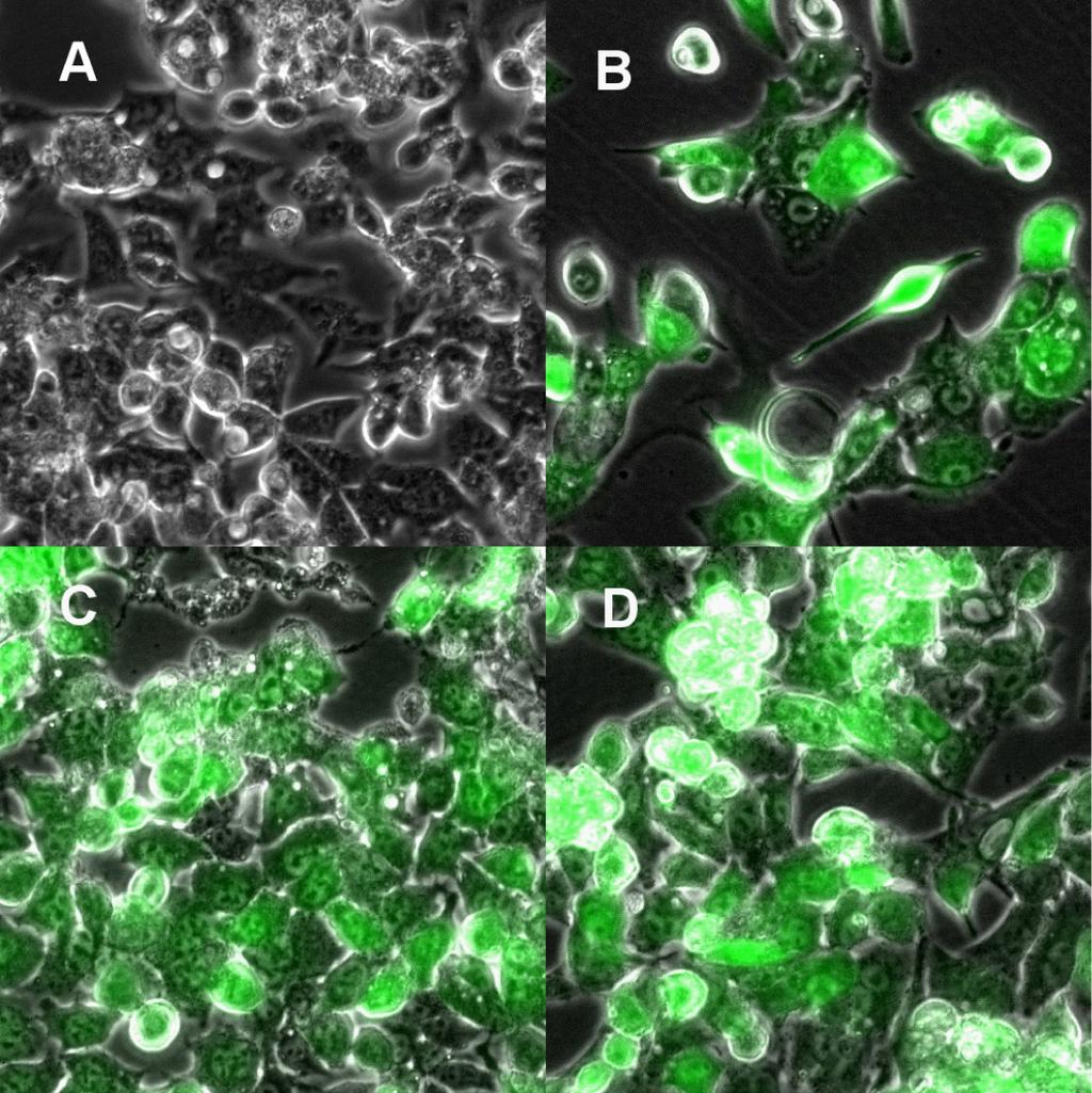 김진욱외 5 인. 렌티바이러스매개 short hairpin RNA 의항 HBV 효과 Figure 3. Green fluorescent protein (GFP) expression in HepAD38 cells transduced with shrna-encoding lentivirus.