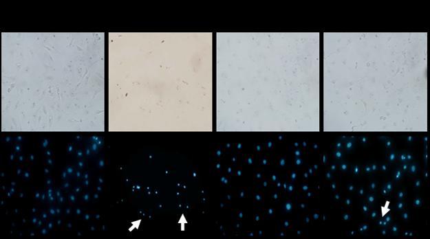 Results cellular apoptosis by Hoechst 33342 staining