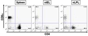 The resident population of γδ T cells might interact with MICA- and/or MICBexpressing solid tumor cells through the natural-killercell receptor NKG2D and/or T-cell receptor (TCR), or recognize
