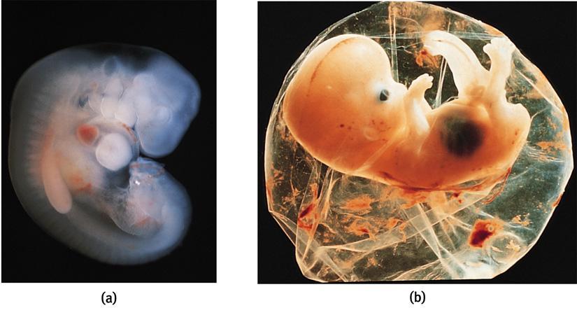 배아기 (embryo) 수정후 2 주부터 ( 착상후 ) 임신 2 개월에이르기까지발달하는뱃속의유기체 Biophoto Associates/