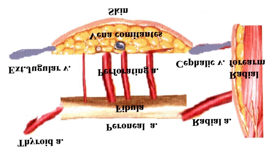 Schematic drawing of double free flap Fig. 3. Case 1.