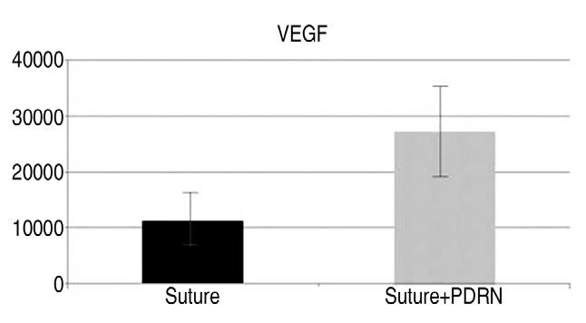 김재윤외 : 피하층열상쥐모델에서 Polydeoxyribonucleotide (PDRN) 가봉합치료에미치는효과 / 457 Suture Suture+PDRN Fig. 5. Microscopic image of VEGF immunohistochemistry ( 200).