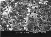 SEM photograph of the fractured surface of SB/30 group, showing mixed failure.