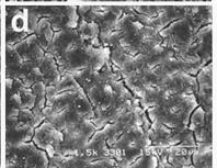 전처리한상아질표면의주사전자현미경관찰 여러가지전처리제로처리된상아질표면에대한주사전자현미경상을