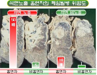 시민환경연구소최예용