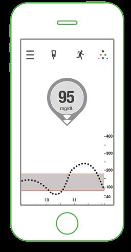 치료결정에 Dexcom G5 Mobile CGM 시스템사용하기 혈중글루코즈