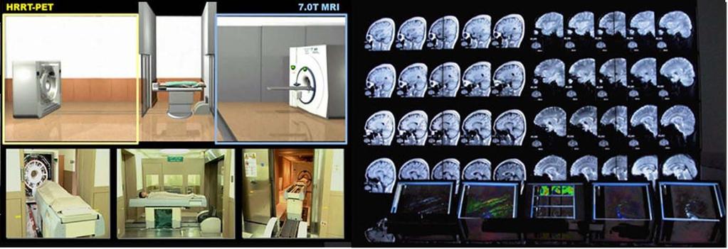 한국과학기술원박현욱교수연구팀은 fmri 영상의 3D visualization 및영상재구성에따른 registration, sementation 등기능적뇌영상에관련된방법론을연구하고있다. 이밖에 fmri 와 EEG 의 multimodal analysis 를위한다양한시도를수행하였으며, in vivo cellular imaging 을연구하고있다.