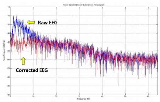 고려대학교강재우교수연구팀은유비쿼터스헬스케어환경에서단일채널뇌파로부터실시간안구잡음제거가가능한 singular spectrum analysis (SSA) 알고리즘을개발하였으며, 이를시간임베딩과정을거쳐관측뇌파로부터안구잡음성분을축출하는방법을개발하였다 ( 그림 3-2 