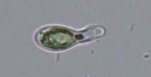(G) A fertile cell having gametes conjugated from the posterior ends of each zoospore (arrows).