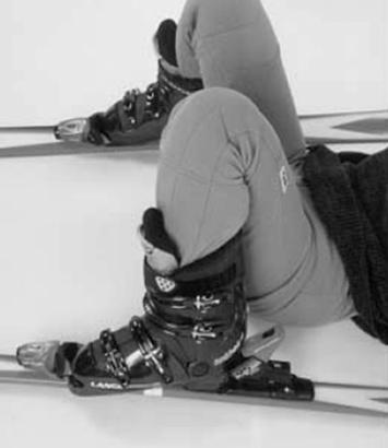 2013 년대한정형외과스포츠의학회추계학술대회 5. Failure of binding release 스키에부적절한외력이가해졌을때, 스키화와스키를고정하는바인더는풀리도록설계되어있다. 이렇게바인더가풀리면경골이외회전되면서전방십자인대의꼬임을막아주는역할을하여서인대손상의위험성이줄어든다 (Figure 5).