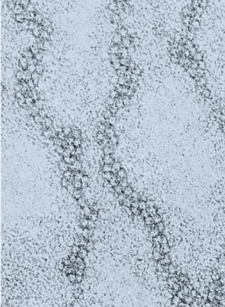Zigzag model; fiber 의반대쪽에있는연속적인 nucleosome 사이를직선으로연결하여 Zigzag 모양
