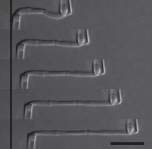 Stretching a chromosome Chromosome 의 elasticity 를측정하여염색체의구조를조사함. Suction 을이용하여염색체를 pipette 내로흡입시킨후한쪽 pipette 은고정시키고다른한쪽 pipette 은이동시키면서그안에서염색체의변하는모습을관찰함. 위의과정을실험하면서각각다른효소로처리하여염색체의모습을관찰.